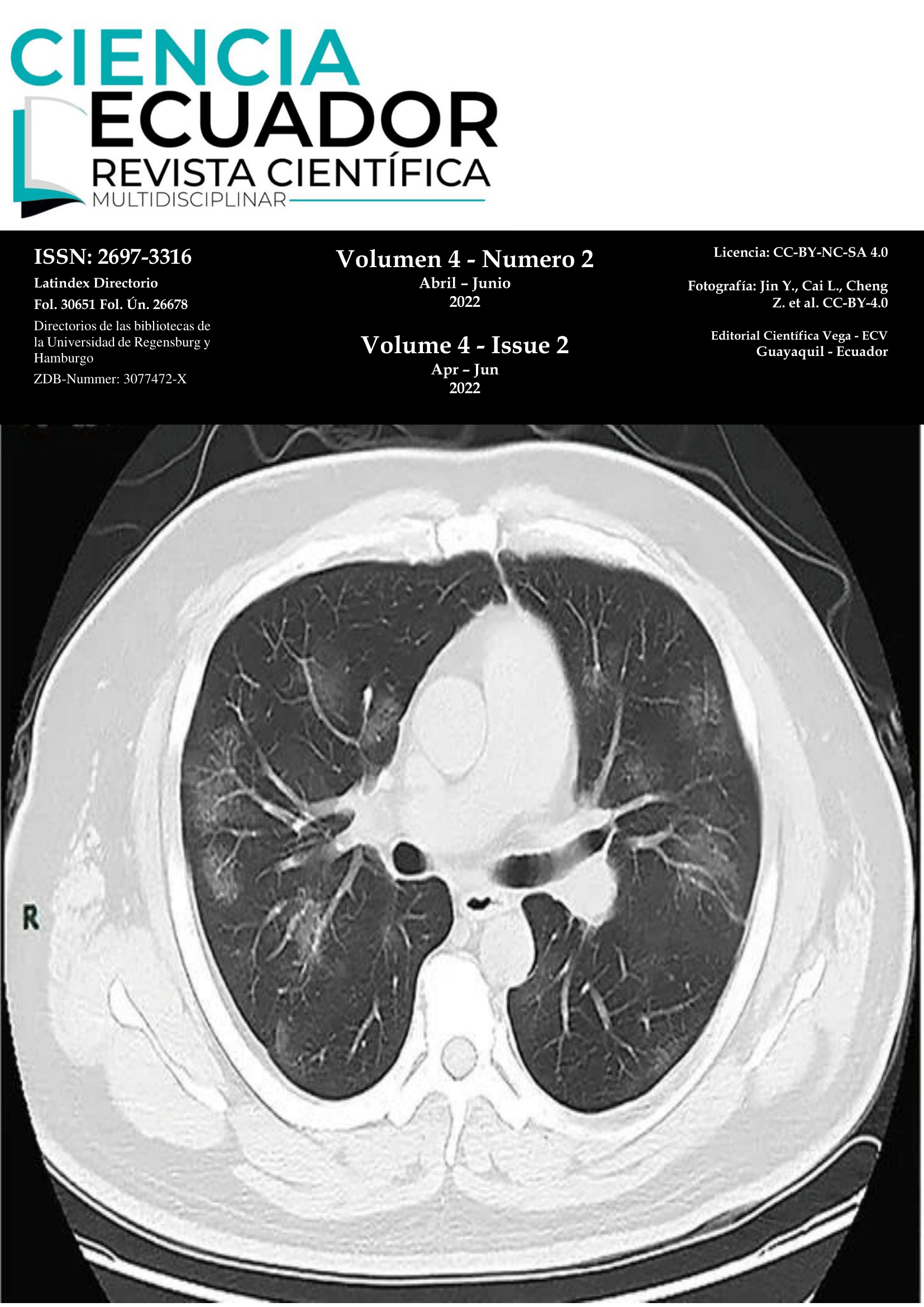 					Ver Vol. 4 Núm. 2 (2022): COVID-19
				
