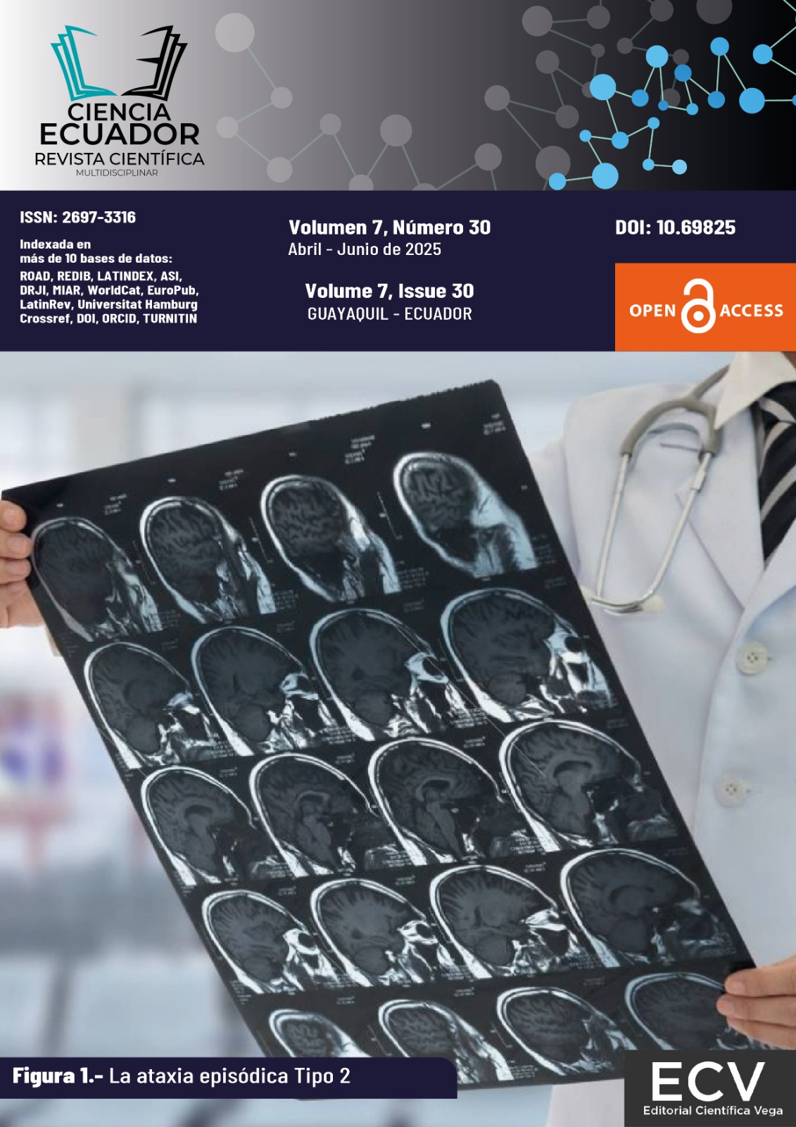 					Ver Vol. 7 Núm. 30 (2025): De la ataxia episódica a otras ciencias
				