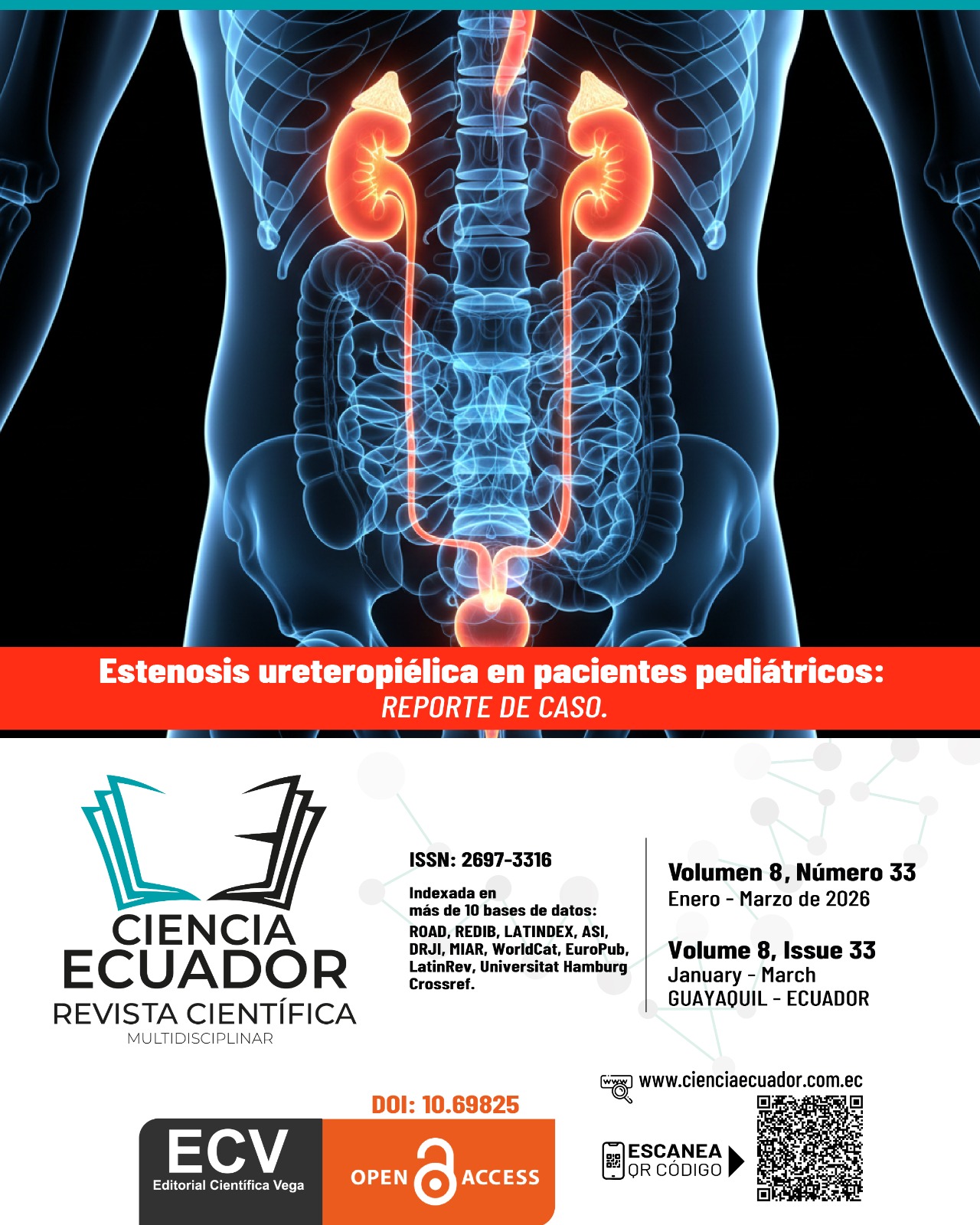 					Ver Vol. 8 Núm. 33 (2026): Desde la estenosis ureteropiélica en pacientes pediátricos: enfoque clínico y diagnóstico
				